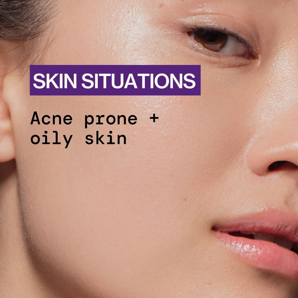 Dry It Out Acne Gel Spot Treatment